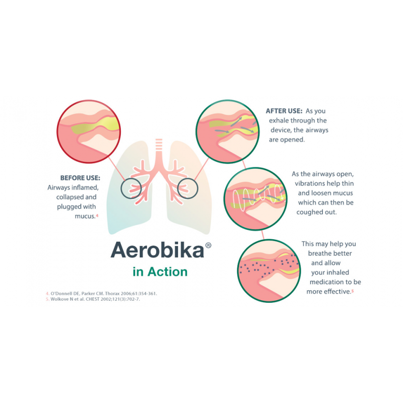 Aerobika Σύστημα Θεραπείας Ταλάντωσης PEP